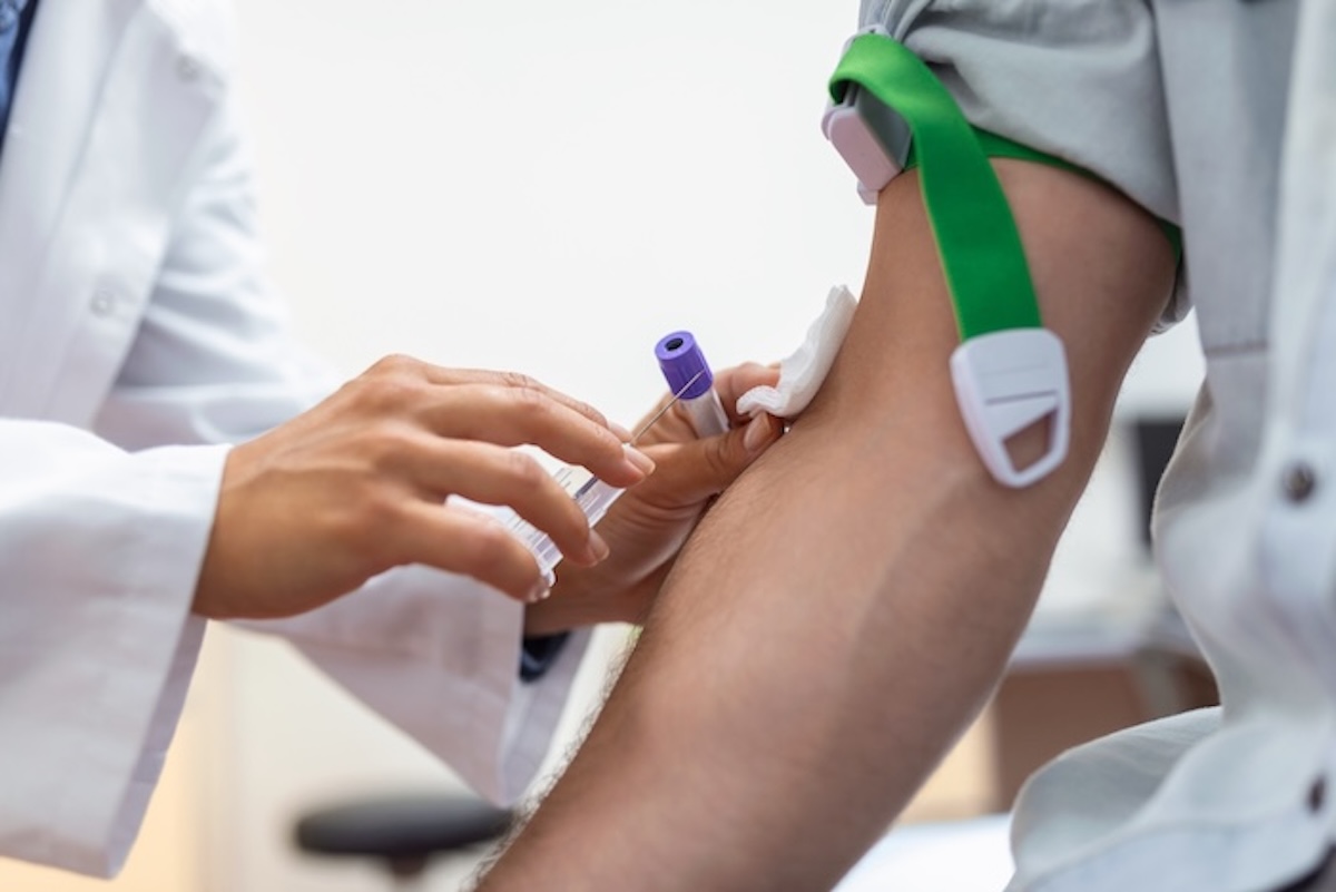 La limitata efficacia degli esami del sangue e delle urine nell’accertare l’alterazione psico-fisica dell’automobilista